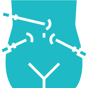 Laparoscopic Surgery