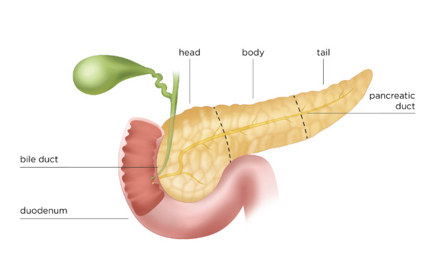 pancreatitis treatment in kolkata