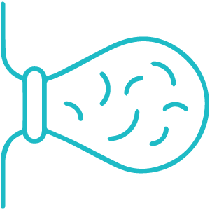 rubber band ligation