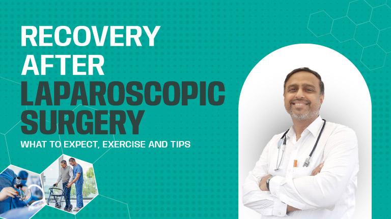 Exercise & Tips for Laparoscopic Surgery Recovery