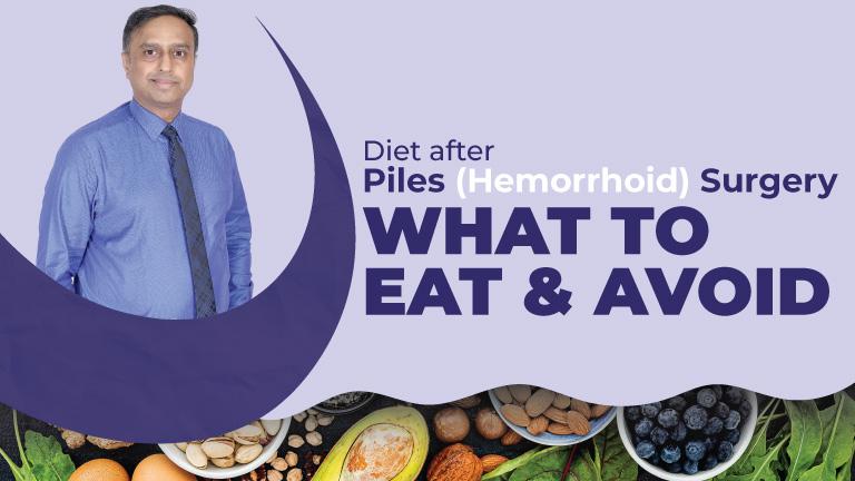 Diet Plan After Piles (Hemorrhoid) Surgery