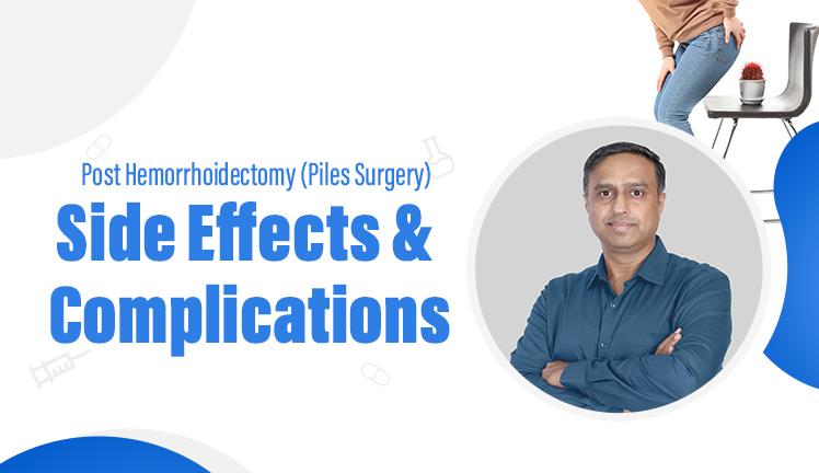 Side Effects & Complications Post Hemorrhoidectomy (Piles Surgery)