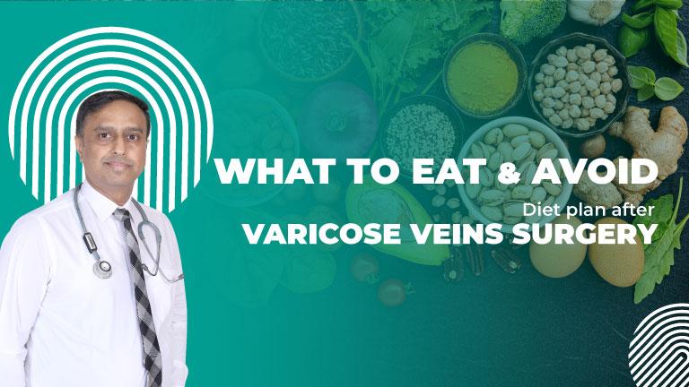 Foods to Eat & Avoid After Varicose Veins Surgery